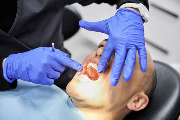 Best Emergency Denture Repair in St Joseph, MN