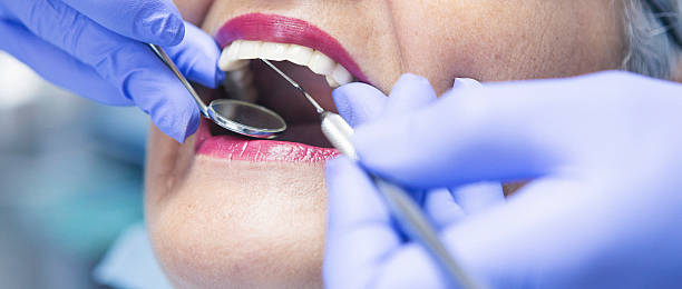 Best Emergency Denture Repair in St Joseph, MN